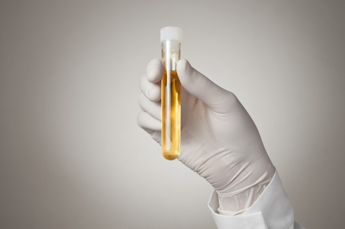 urine infection testing