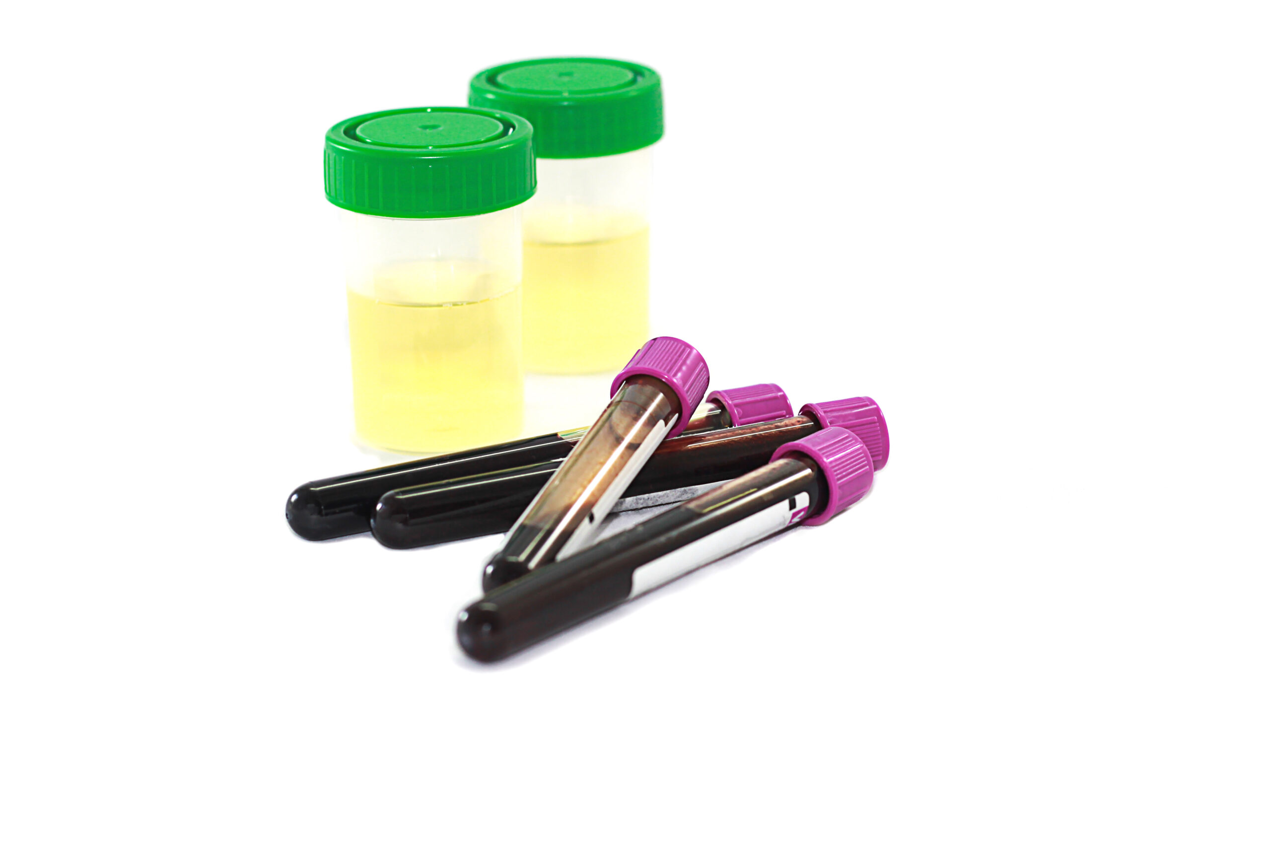 Urine specimen testing