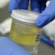 urine sample testing