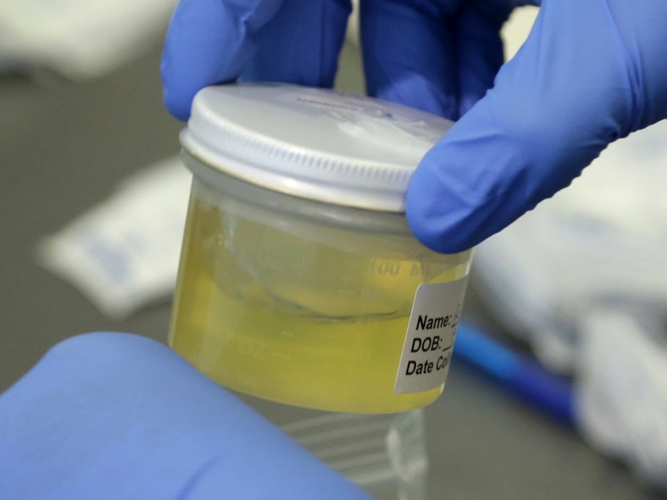 urine sample testing