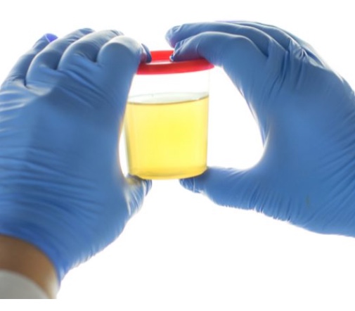 Peezy Midstream - easy urine collection