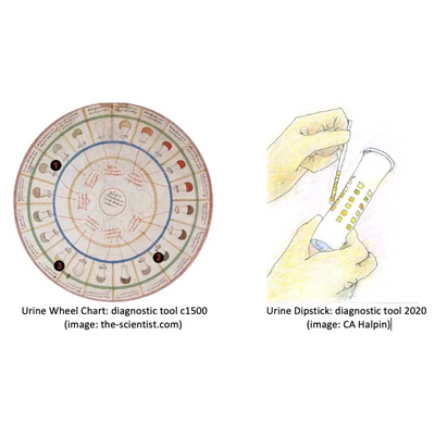 Urine Diagnostic Tools